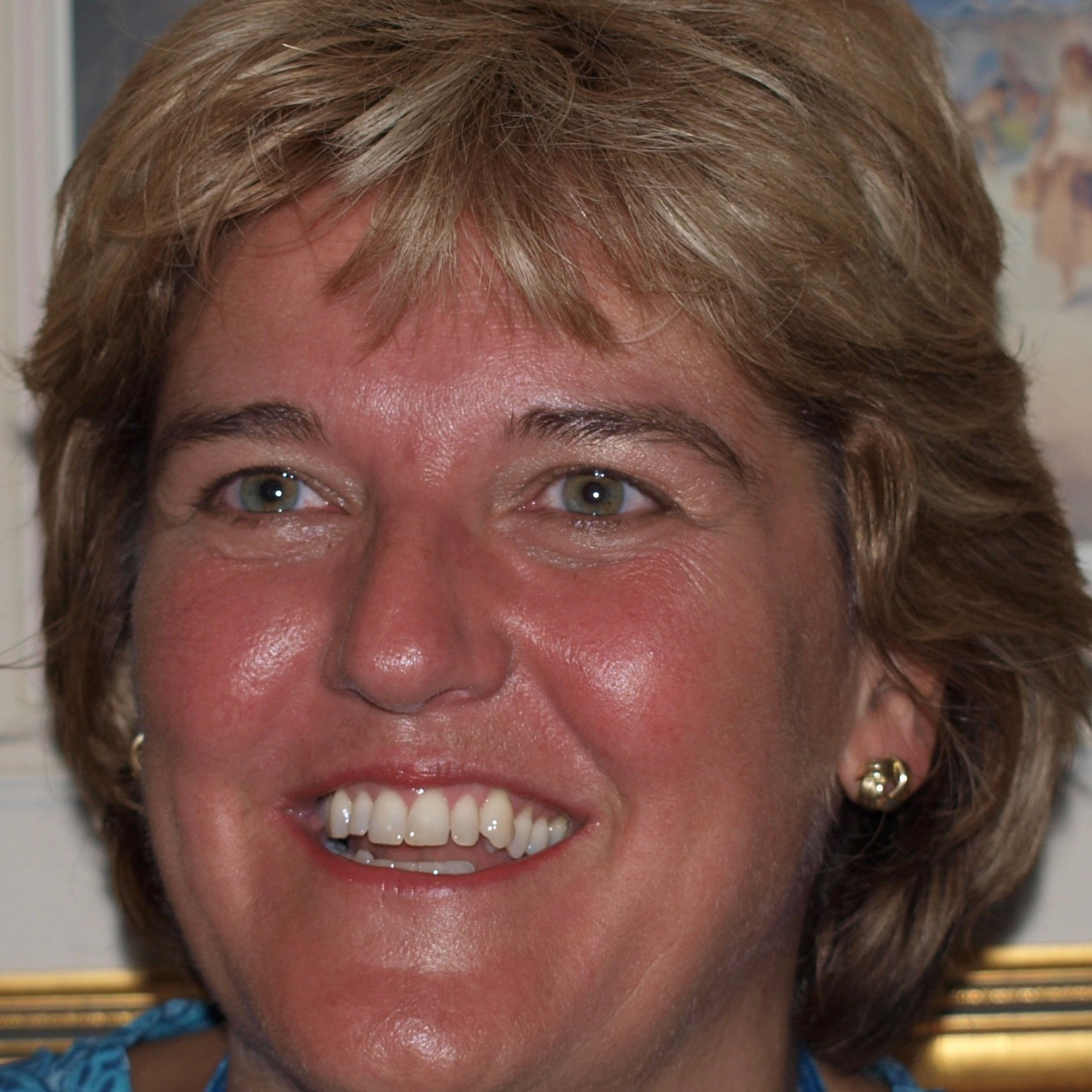 Anne  Watson